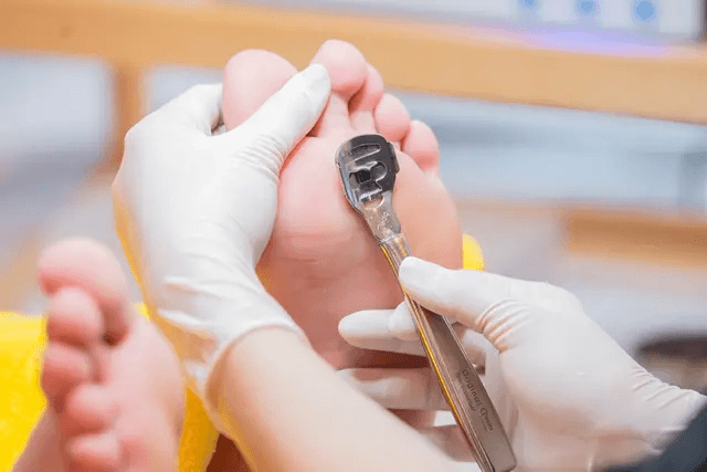 角質ケア（踵）