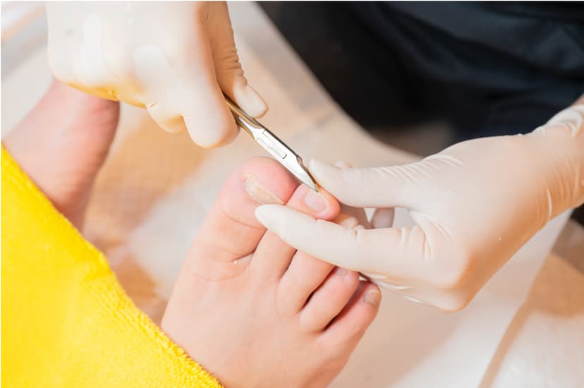 普通の爪切り（厚み・変形のない爪）